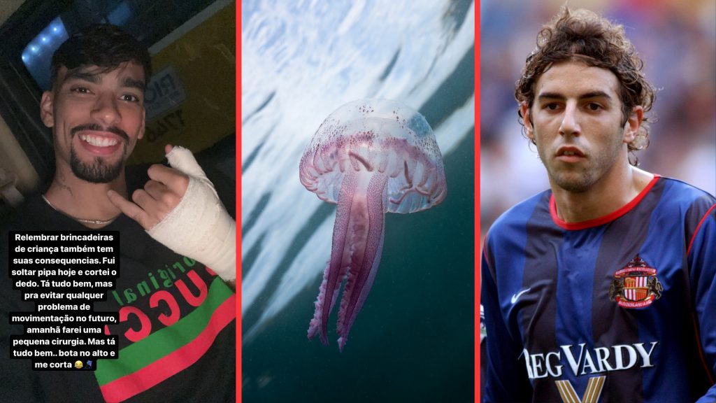 freak injuries to footballers