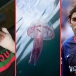 freak injuries to footballers